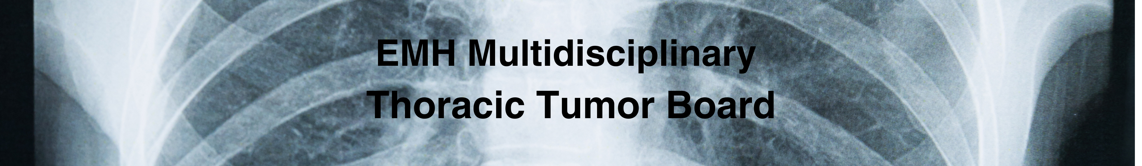 2025 EDW Multidisciplinary Thoracic Tumor Board (RSS) Banner